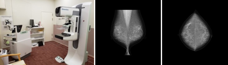マンモグラフィ（Mammography）