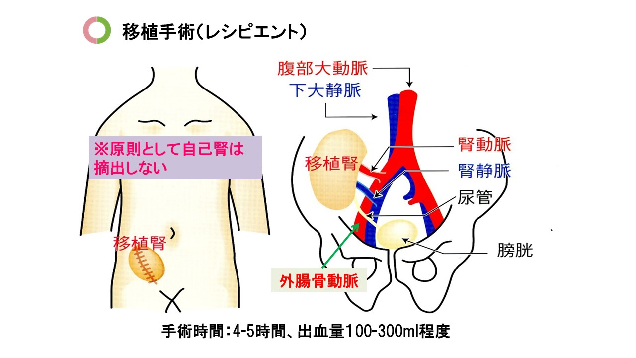 レシピエント手術 | 友愛医療センター - 社会医療法人友愛会