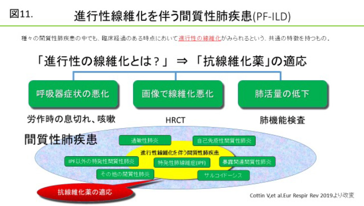 図11：進行性線維化を伴う間質性肺疾患（PF-ILD）について